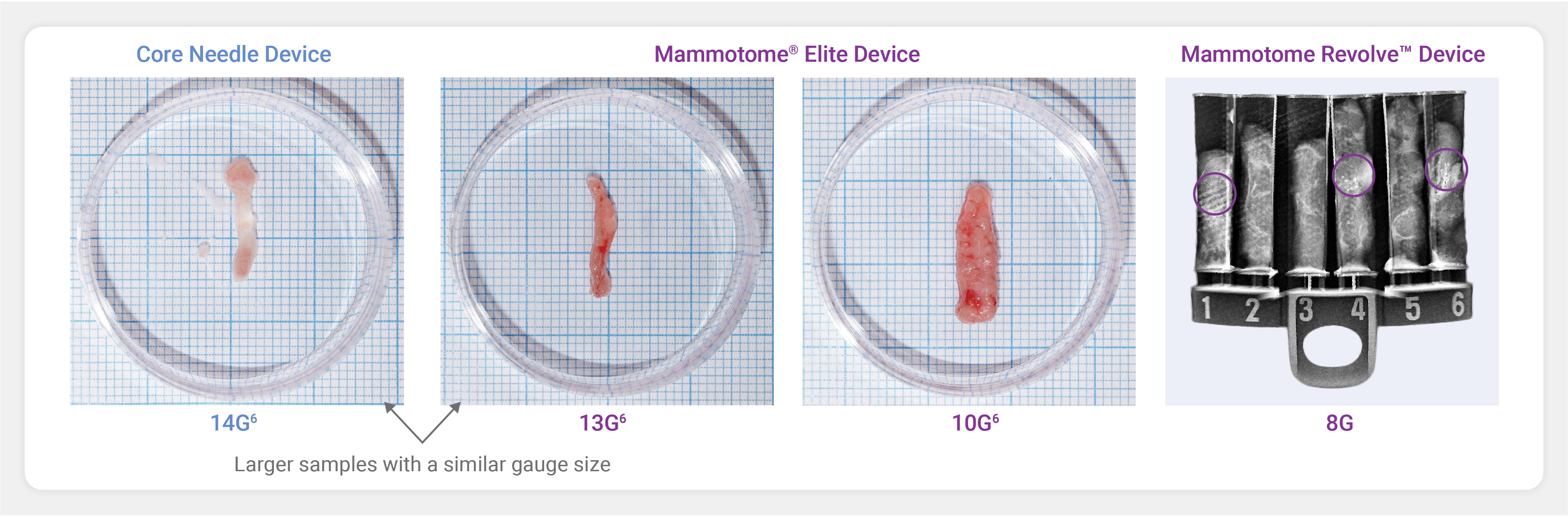 tissue samples of core needle device vs Mammotome VAB devices